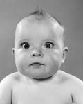 1950s Close-Up Of Baby Cross-Eyed