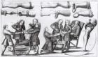 Surgical operations on limbs (engraving) (b/w photo)