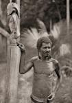 Malformation of the ears. A man from the Solomon Islands with pierced ear lobes which are enlarged by discs, and wearing a nose ring. After a 19th century photograph. From Customs of The World, published c.1913.