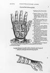 Description of a mechanical iron hand (engraving) (b/w photo)