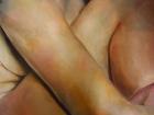 An arm and a leg, 2007, (oil on card)