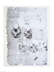 Five Views of a Fetus in the Womb | Obraz na stenu
