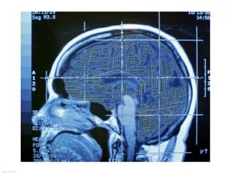 Close-up of an MRI scan of the human brain | Obraz na stenu