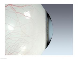 Close-up of the human eyeball | Obraz na stenu