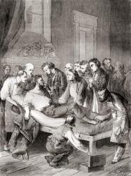 The first public demonstration of the use of inhaled ether as a surgical anaesthetic in 1846 by an American dentist, William Thomas Green Morton, from 'Les Merveilles de la Science', published c.1870 | Obraz na stenu