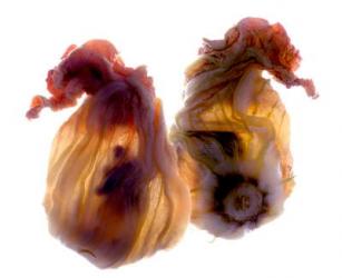 Zucchini Blossom Duo, 2009, (digital photogram, digital original print) | Obraz na stenu