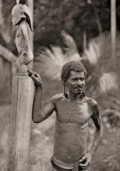 Malformation of the ears. A man from the Solomon Islands with pierced ear lobes which are enlarged by discs, and wearing a nose ring. After a 19th century photograph. From Customs of The World, published c.1913. | Obraz na stenu