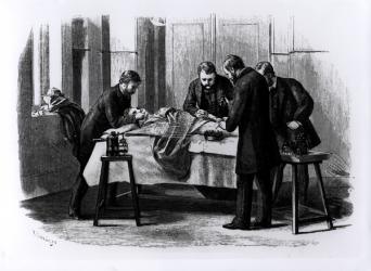 Antiseptic Surgery, 1882 (engraving) (b/w photo) | Obraz na stenu