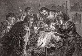La Dentiste, The Dentist by Gerard van Honthorst. Dentistry in the 17th century. From Histoire des Peintres de Toutes les Écoles, École Hollandaise, published 1863. (litho) | Obraz na stenu