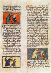 Ms H 89 fol.17r Surgery, from an edition of the 'Book of Surgery' by Rogier de Salerne (vellum) | Obraz na stenu